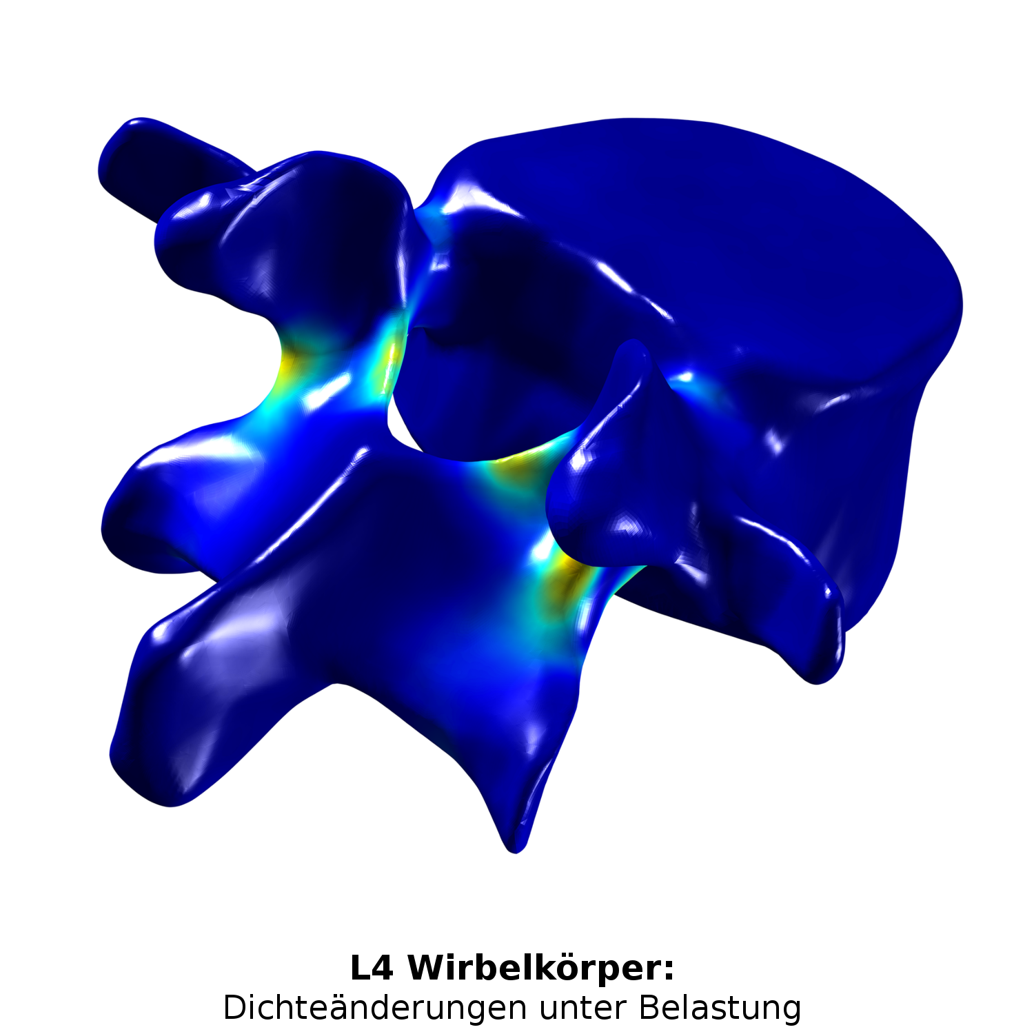 L4 Wirbelkörper unter Belastung