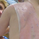 Bacteriosafe_Schoenherr