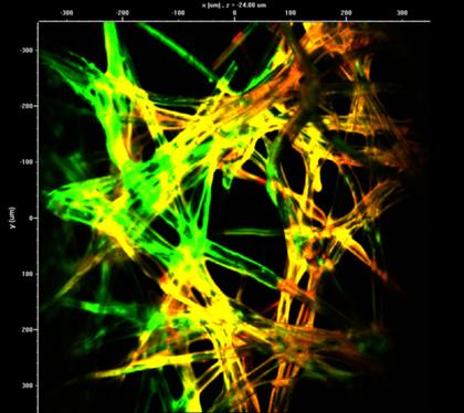 Laserscanning-Aufnahme einer eingefärbten Mikrostruktur